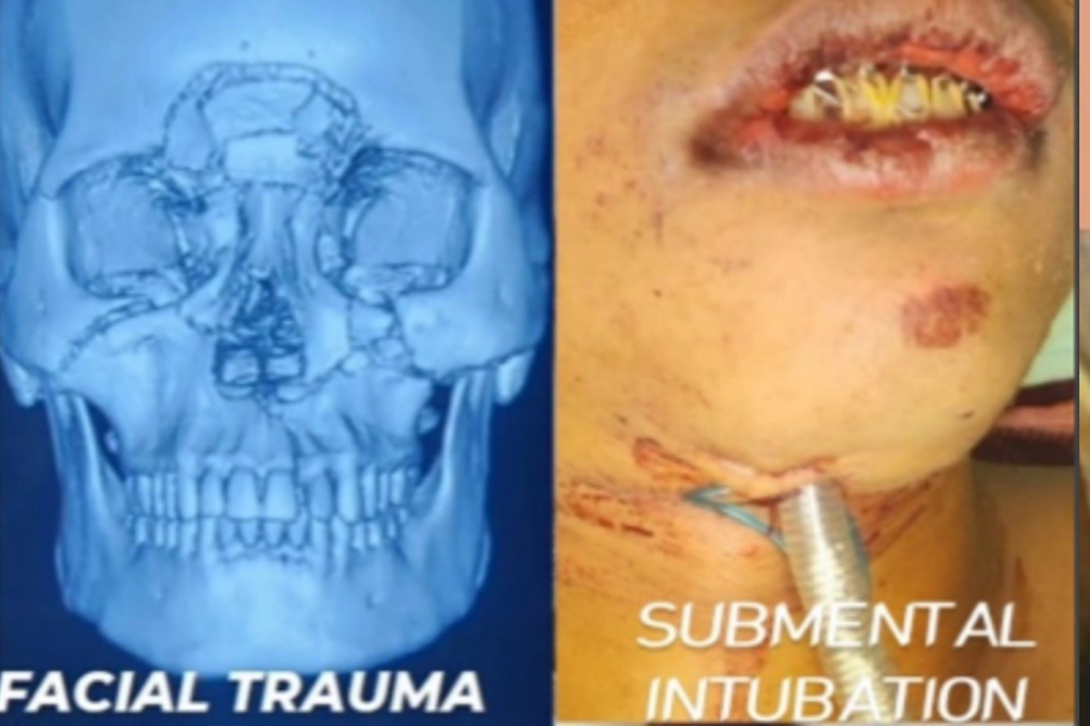 Shri. Devendra Fadnavis